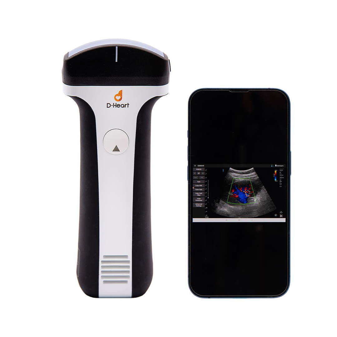 buy online Portable Ultrasound Handheld Probe(Lu700L)- D-Heart 1  Qatar Doha