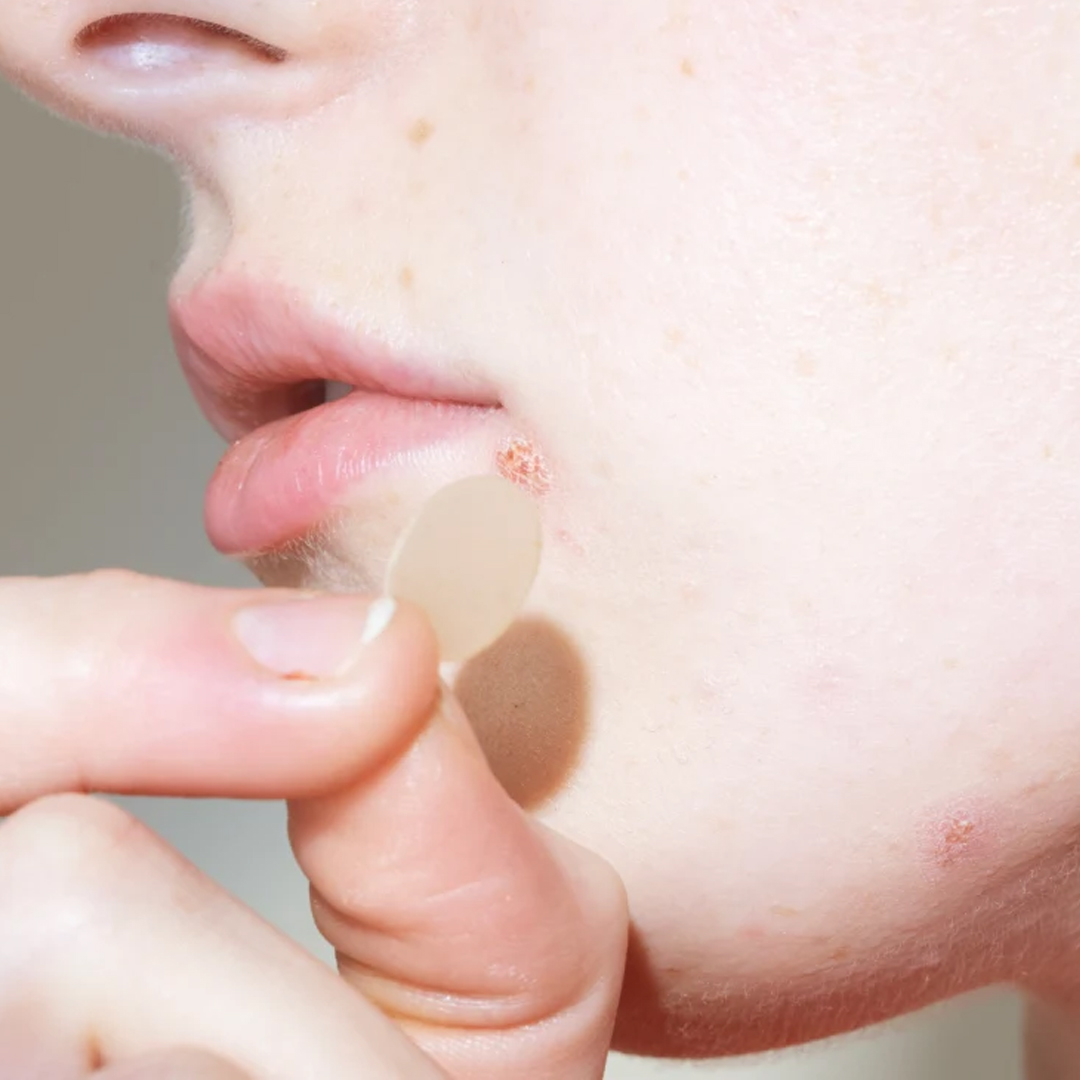 Acne Patch available in online  pharmacy qatar, doha 